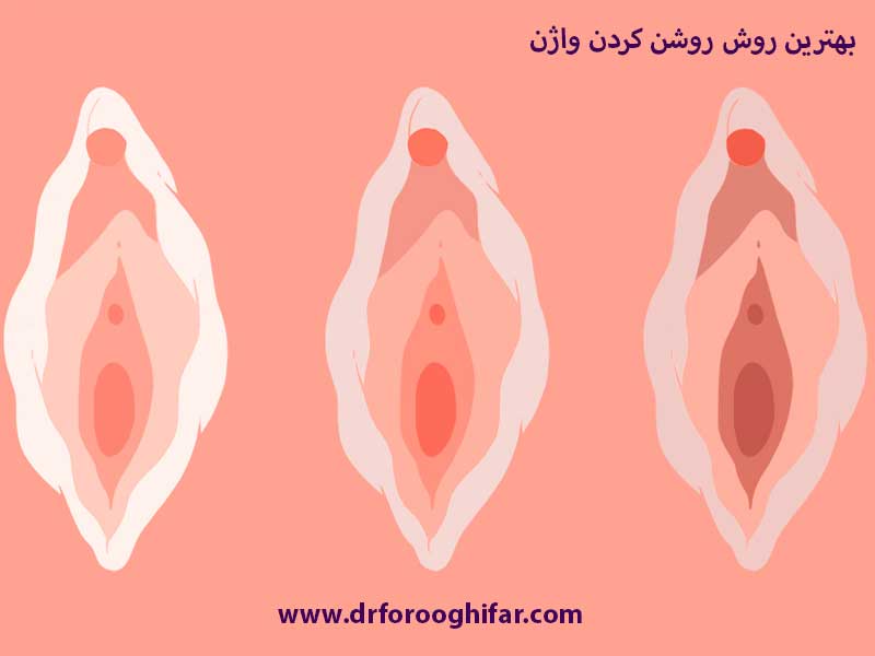 روشهای روشن کردن واژن در تهران5 (2)