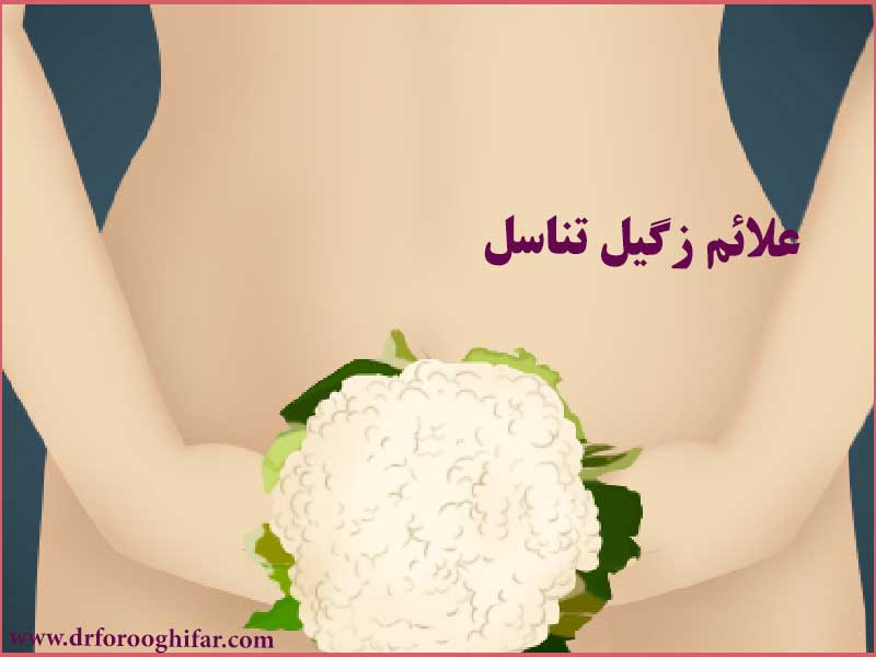  یهترین دکتر زنان درمان زگیل تناسلی در تهران