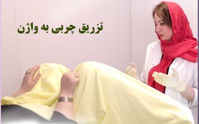 تزریق چربی به واژن در تهران3.5 (6)