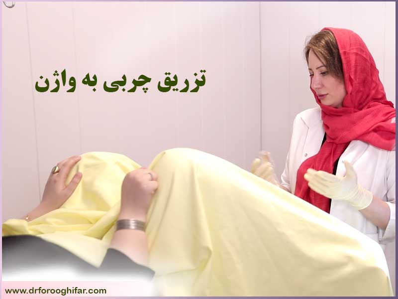 تزریق چربی به واژن در تهران4 (4)